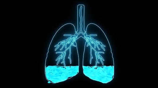 肺水肿是一种由肺泡中异常液体引起的疾病导致患者缺氧视频的预览图