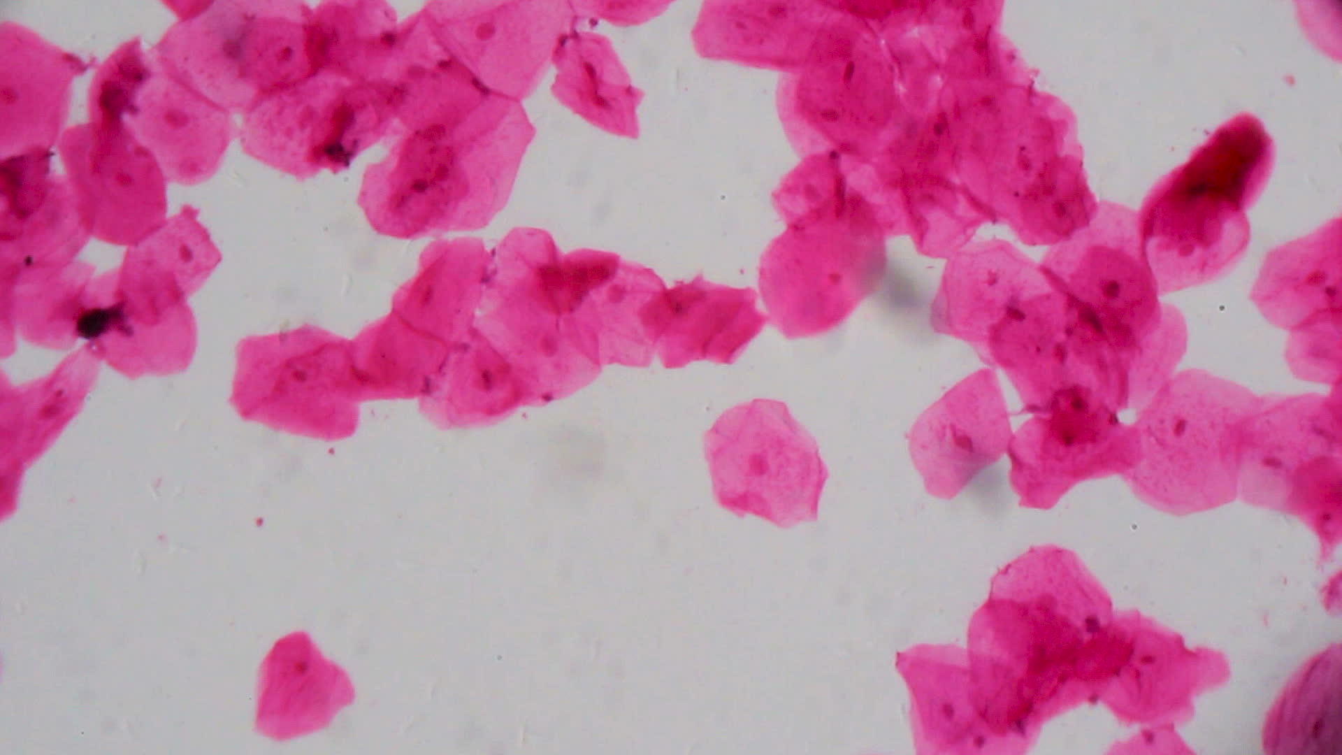 显微镜下多孔相上皮白色背景上的抽象粉色点视频的预览图