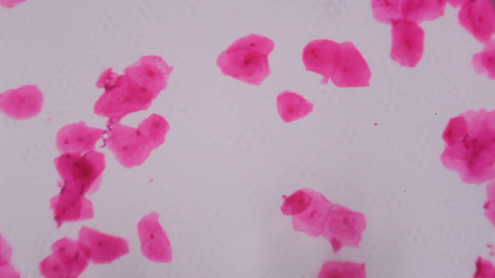 显微镜下多孔相上皮白色背景上的抽象粉色点视频的预览图
