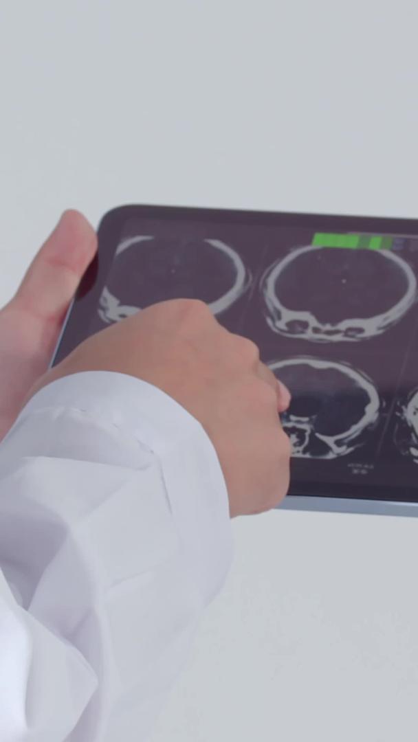 医师对患者头部CT片进行了研究视频的预览图