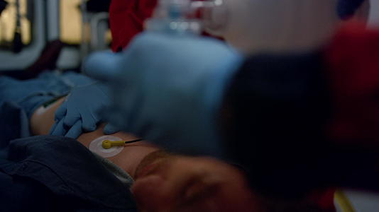 急诊医生在担架上对患者进行心肺复苏手术视频的预览图