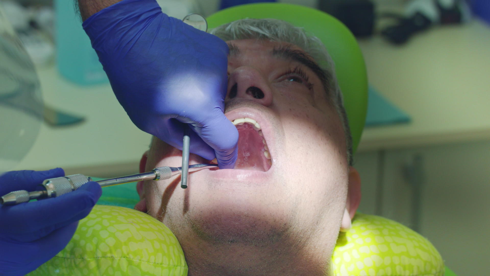 牙齿检查过程视频的预览图