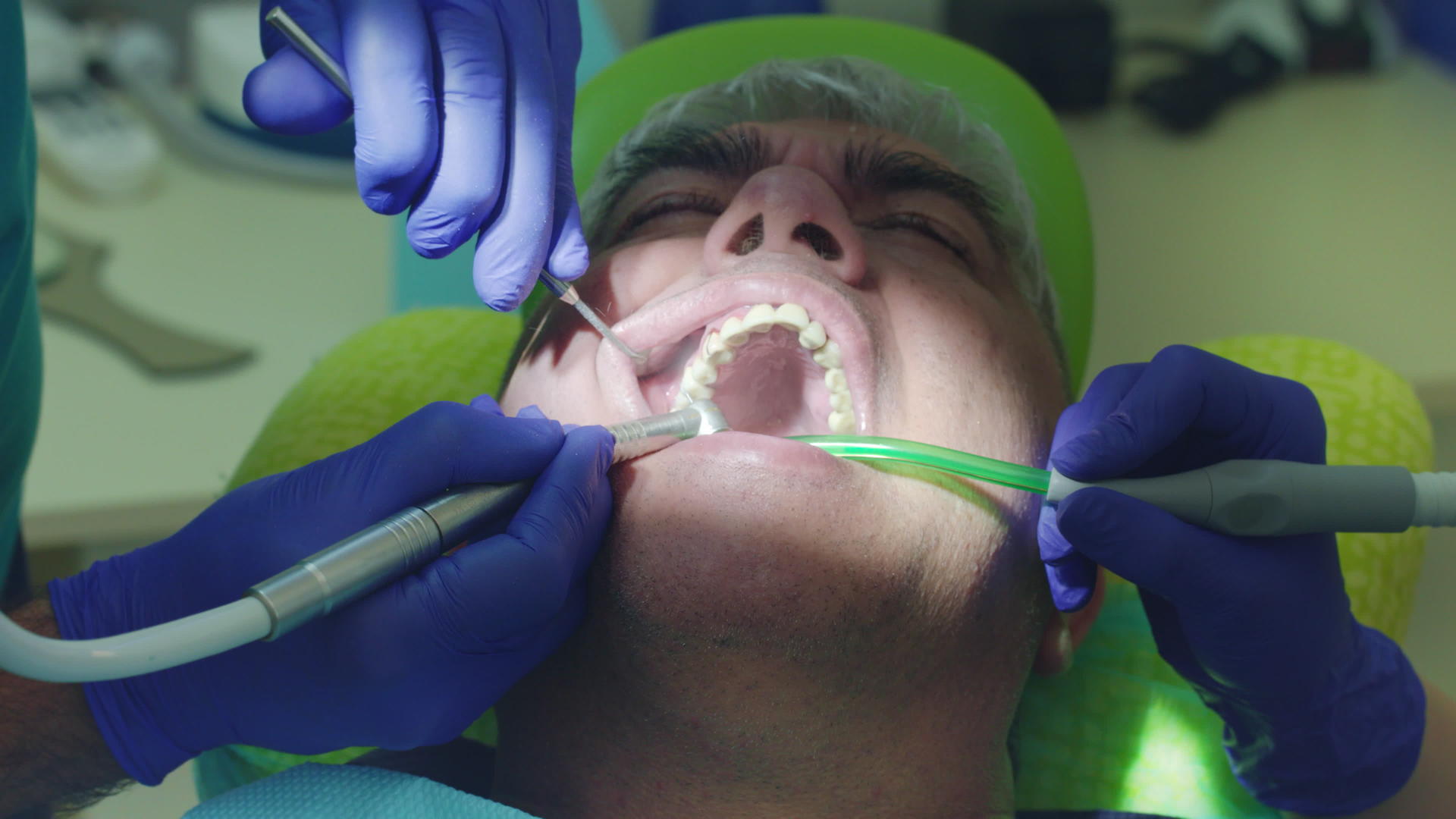 牙医治疗男性患者的牙医视频的预览图