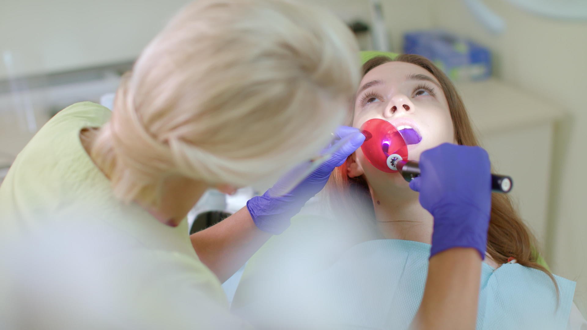 牙医在口腔中使用聚合灯视频的预览图