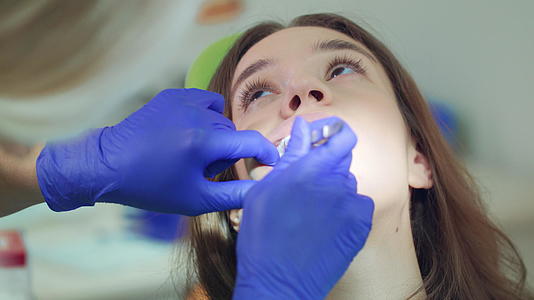 牙医从病人口中取出棉条视频的预览图