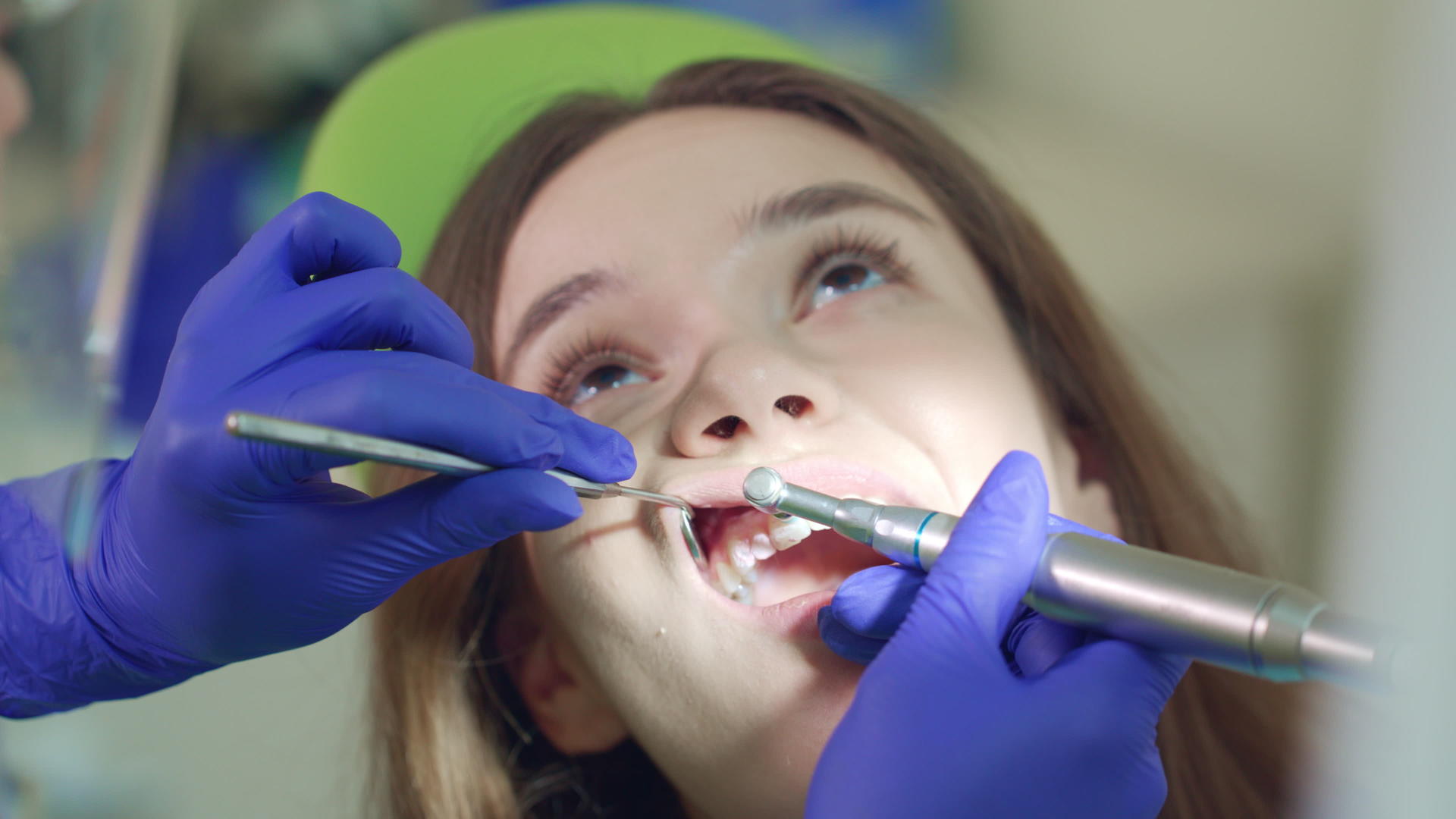 接受牙齿清洁手术的女孩视频的预览图