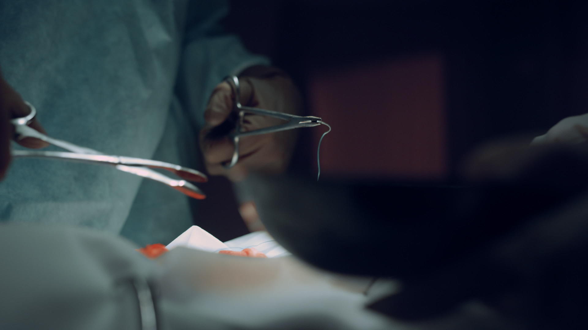 手术医生正在缝合伤口视频的预览图