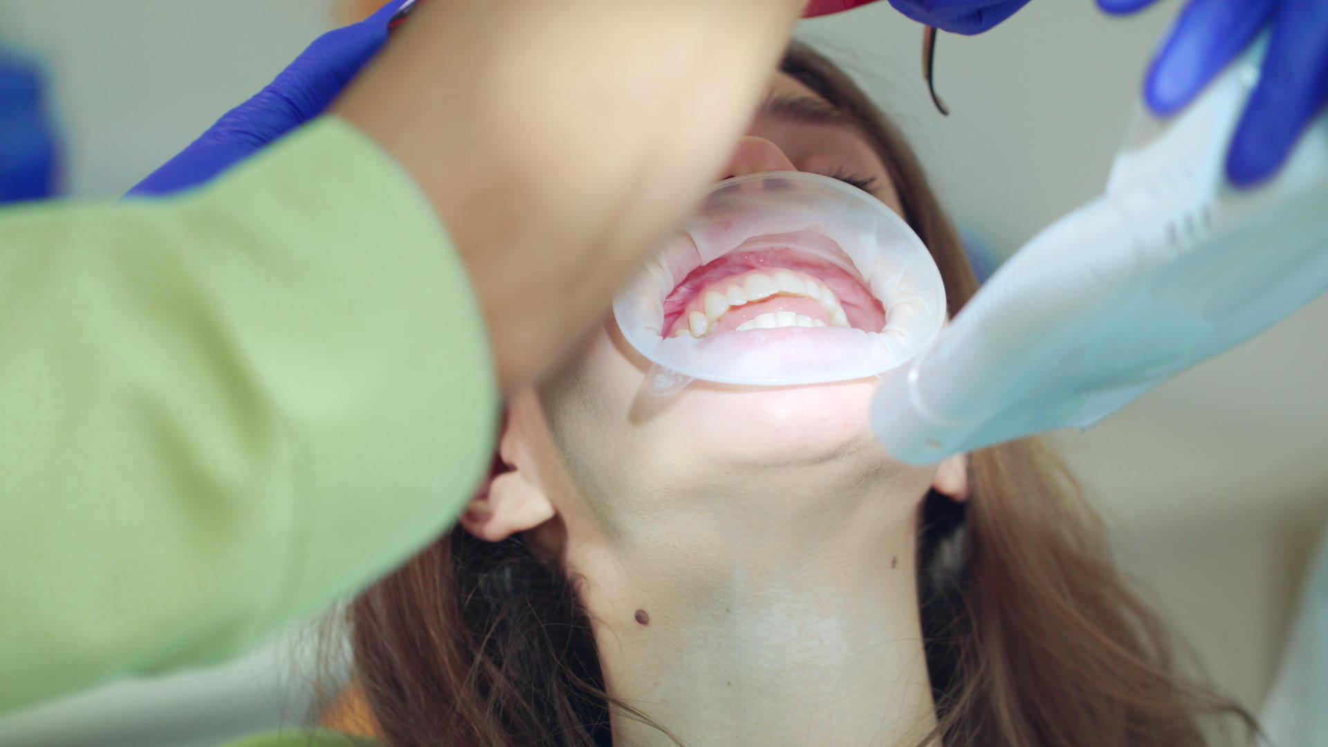 牙科诊所做牙科手术的病人视频的预览图