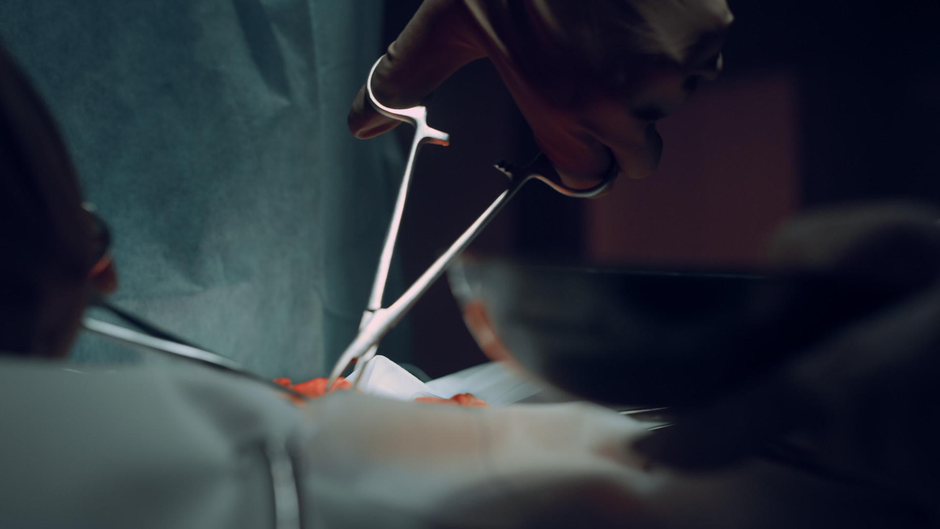 医院手术室的特写外科医生用镊子缝合伤口视频的预览图