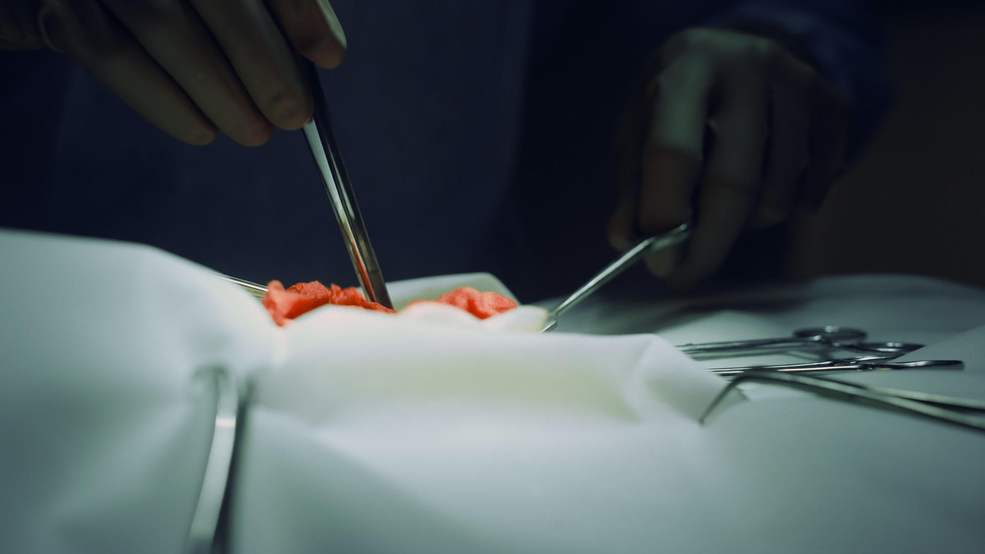 特写外科医生在手术室无菌病房手术视频的预览图