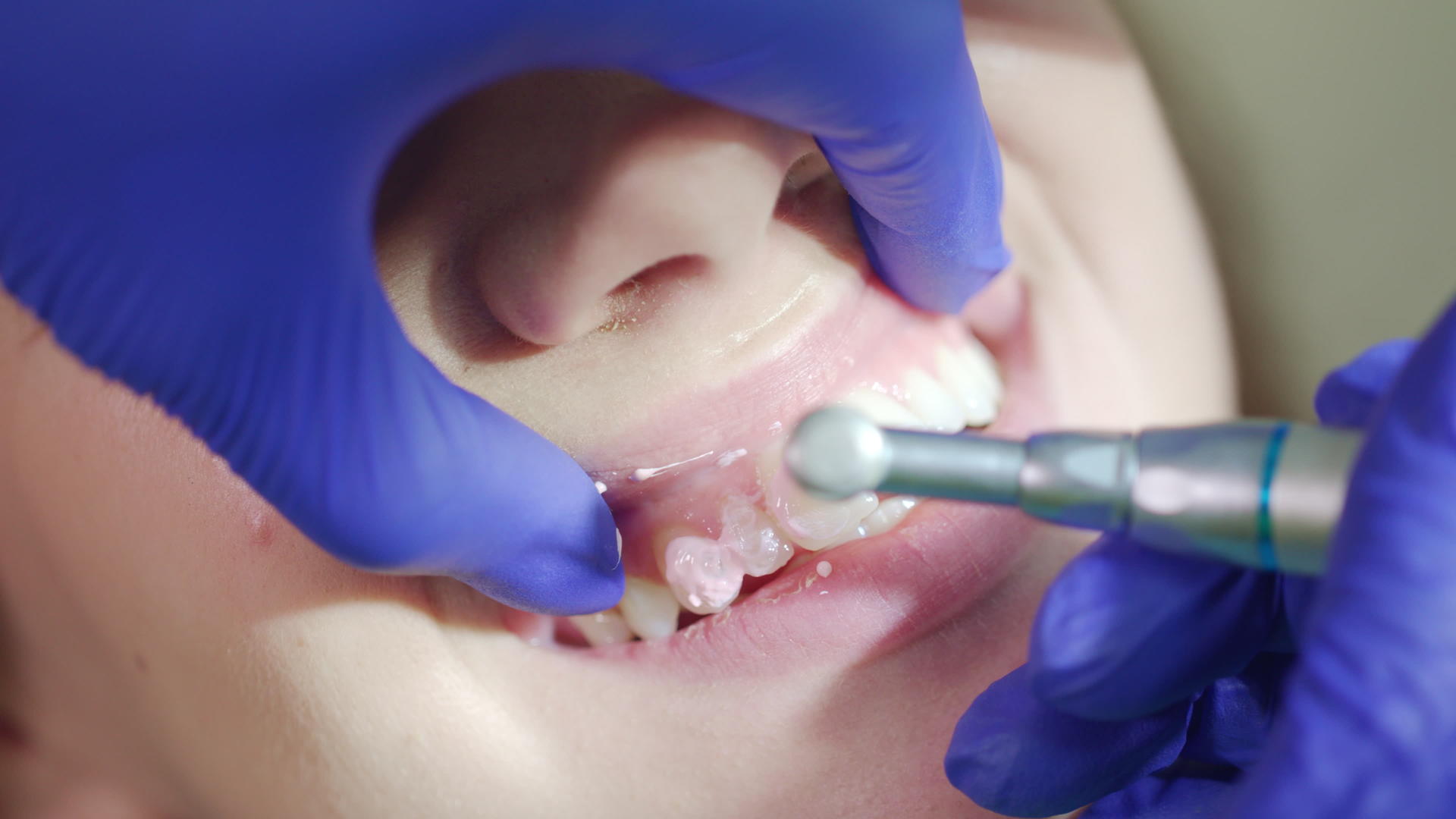 牙科办公室的专业人员视频的预览图