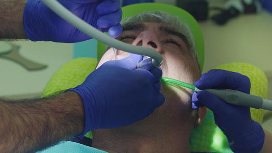 牙医手术过程视频的预览图