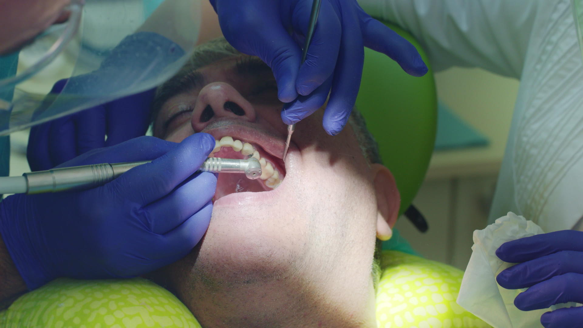 牙科办公室疼痛治疗视频的预览图