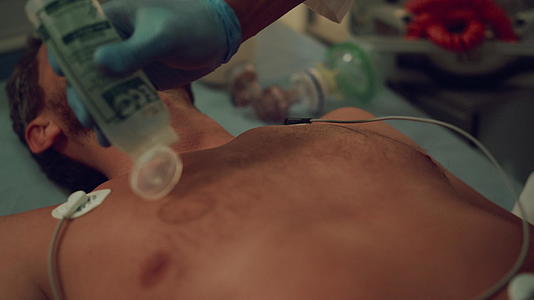 医护人员在急诊室的特写镜头中对失去意识的人进行除颤视频的预览图