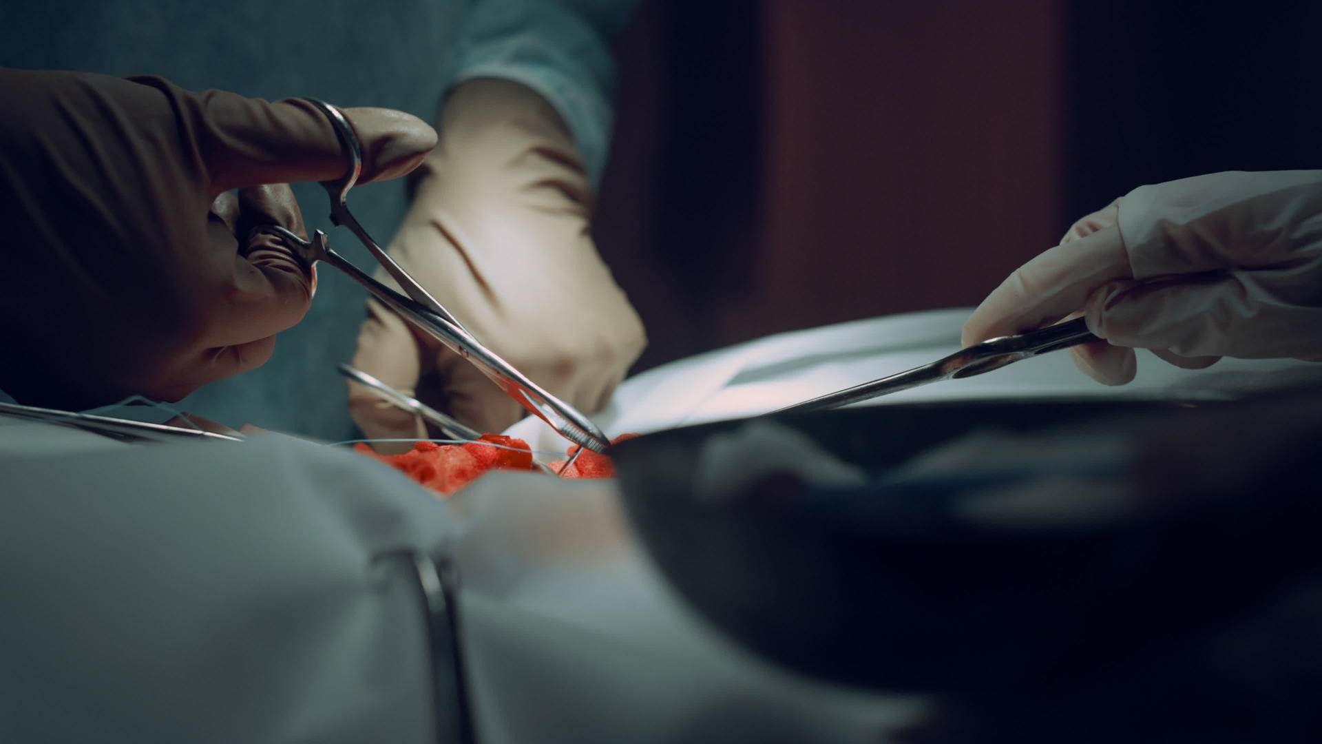 特写外科医生在诊所手术成功后缝合伤口视频的预览图
