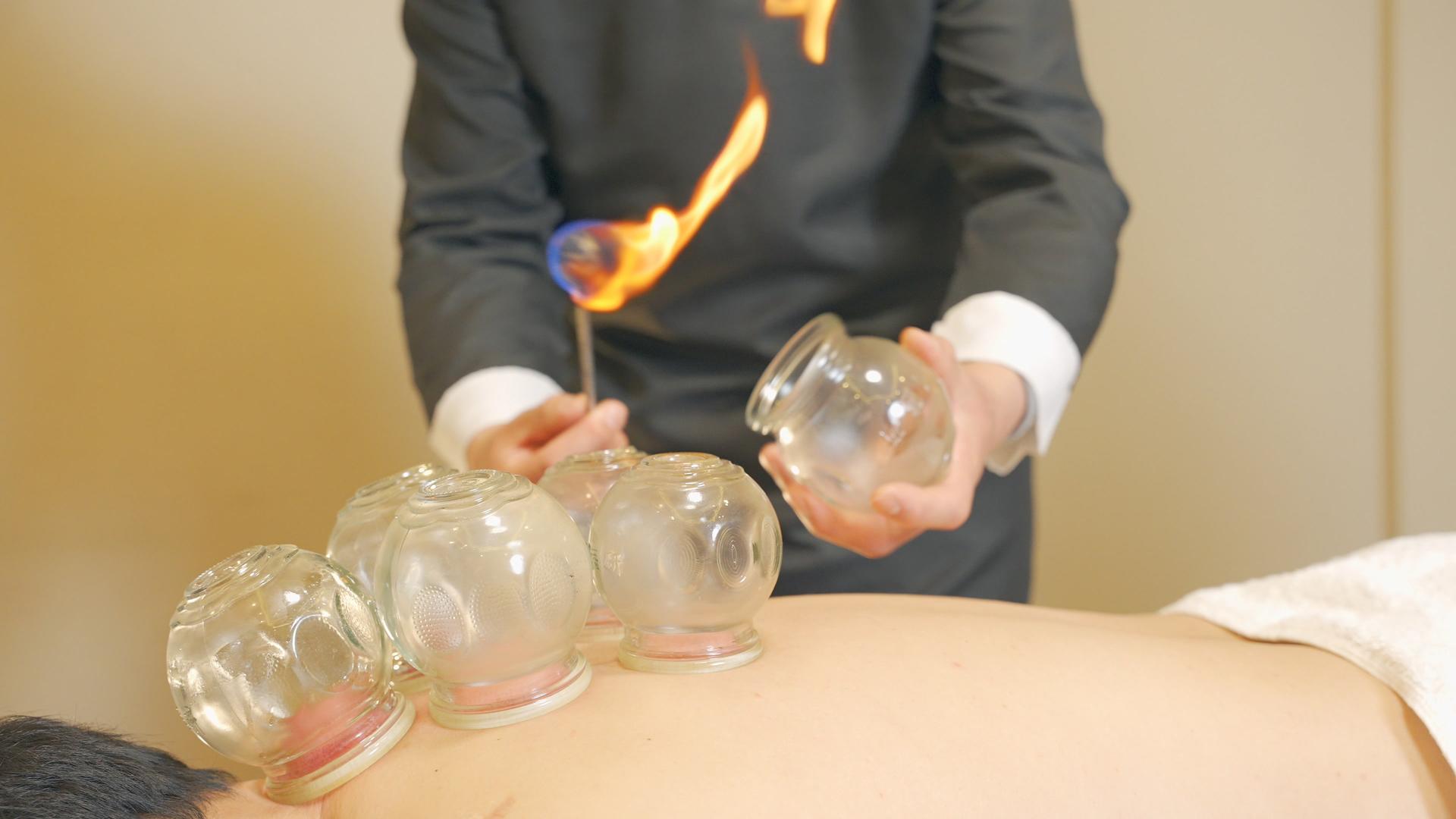中医传统火罐治疗技法视频的预览图