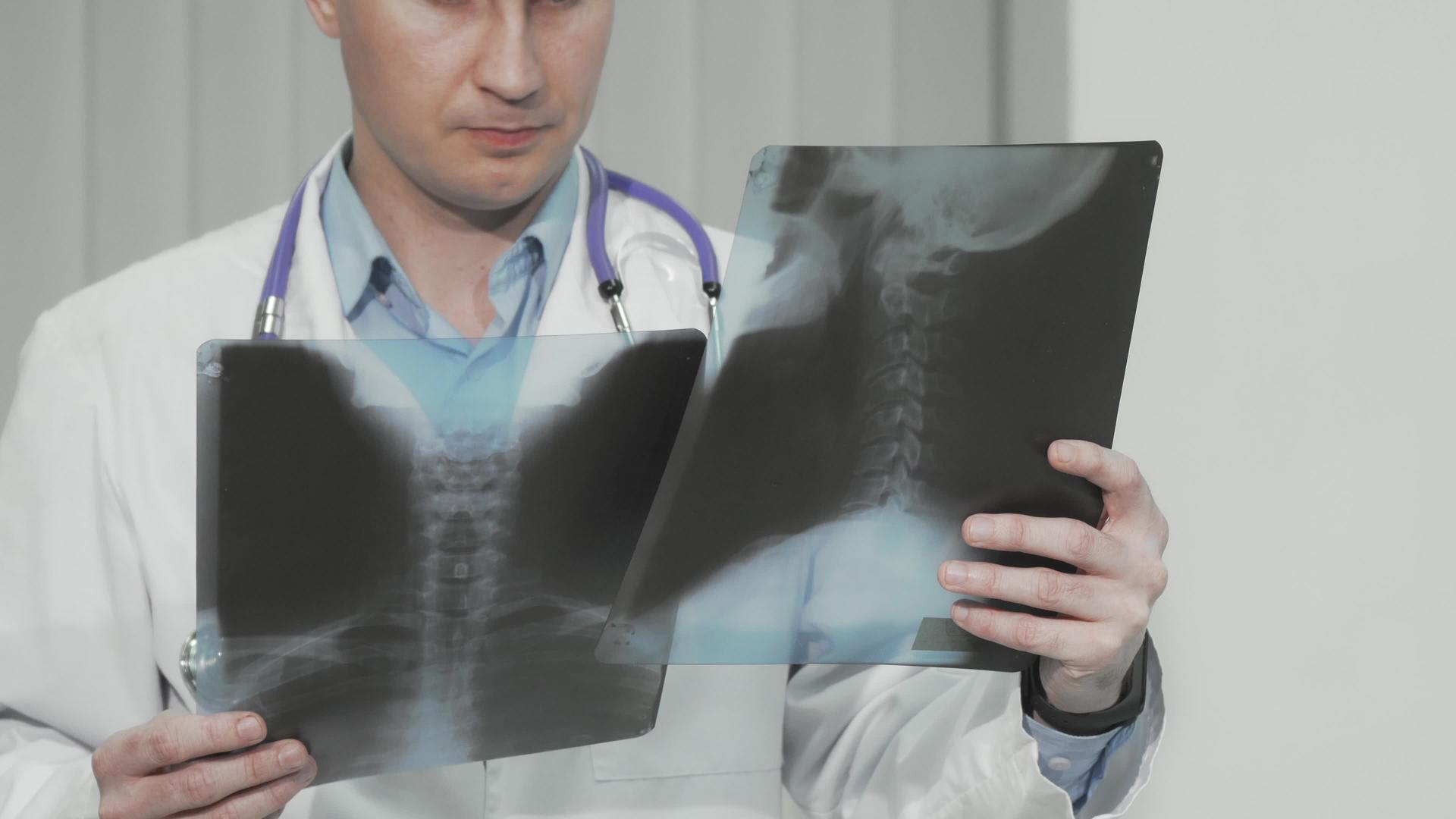 一名医生检查了X光检查患者的X光扫描视频的预览图