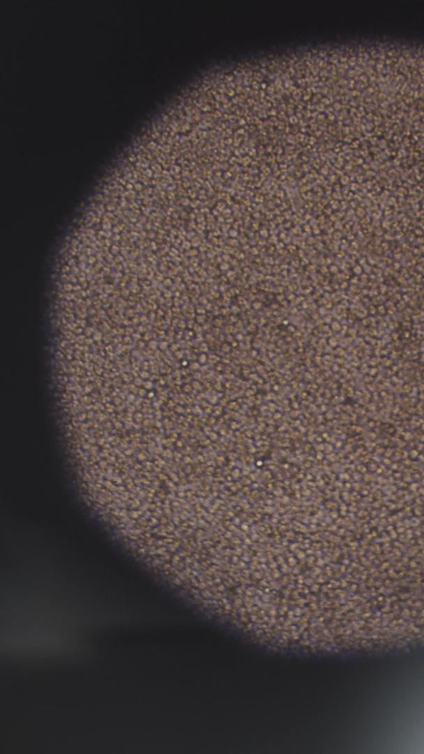 真实的微镜红细胞血小板血样视频的预览图