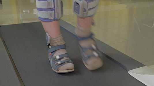 在特殊的整形绷带和脚穿时小男孩的脚在运动车上近视视频的预览图