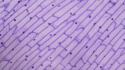 紫洋葱皮在显微镜下视频的预览图