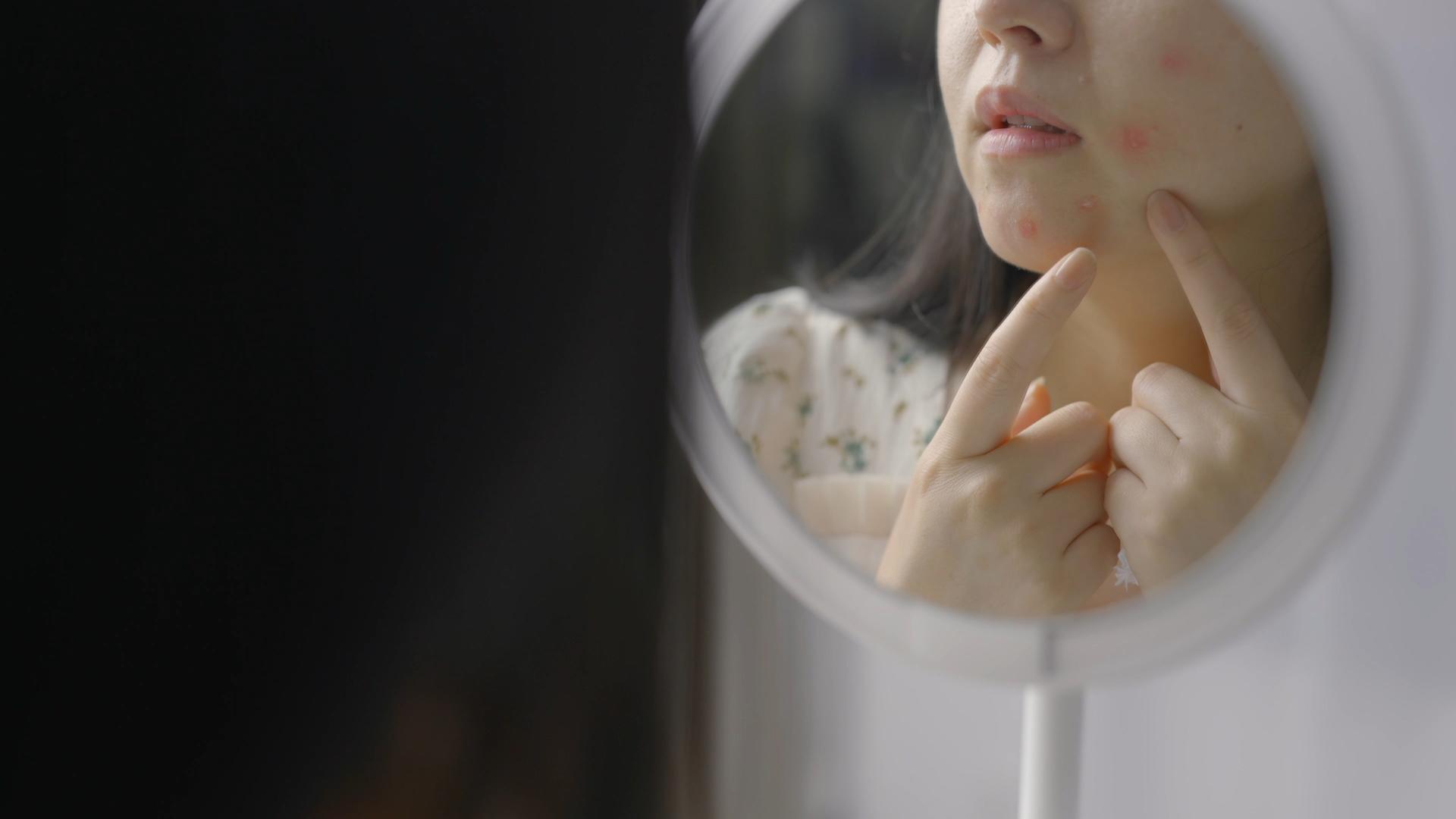 4K女青年化妆镜皮肤气色差青春痘视频的预览图