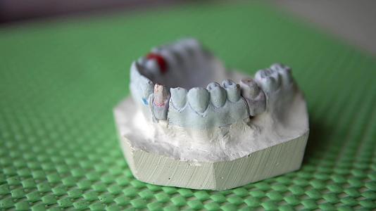 牙科药物假肢牙医视频的预览图