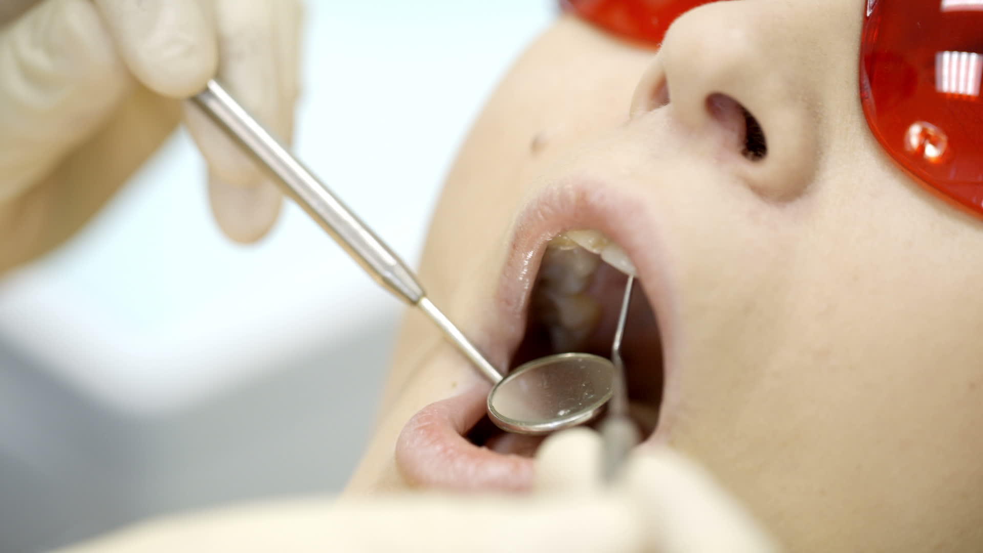 接受牙医检查的妇女人数视频的预览图