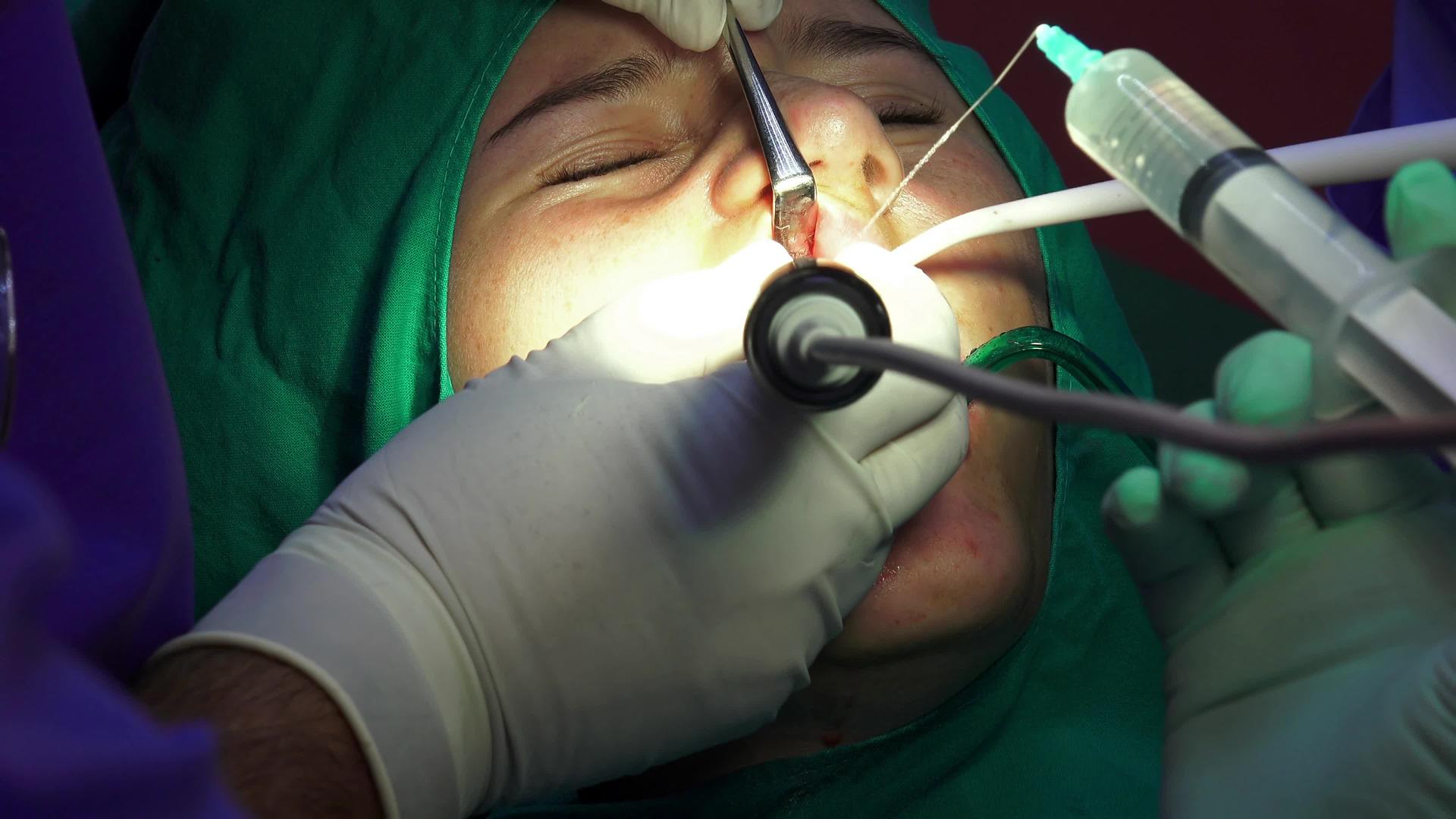 暗室手术室口腔外科手术光谱切片视频的预览图