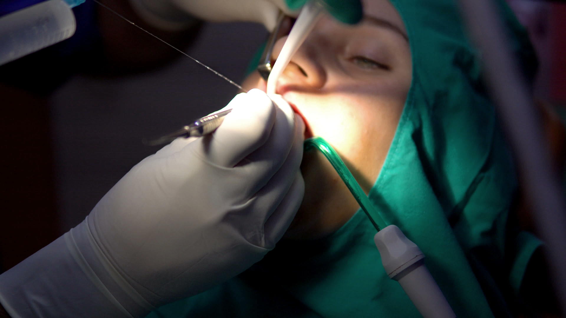 口腔外科直视脑细胞切片黑暗手术室视频的预览图