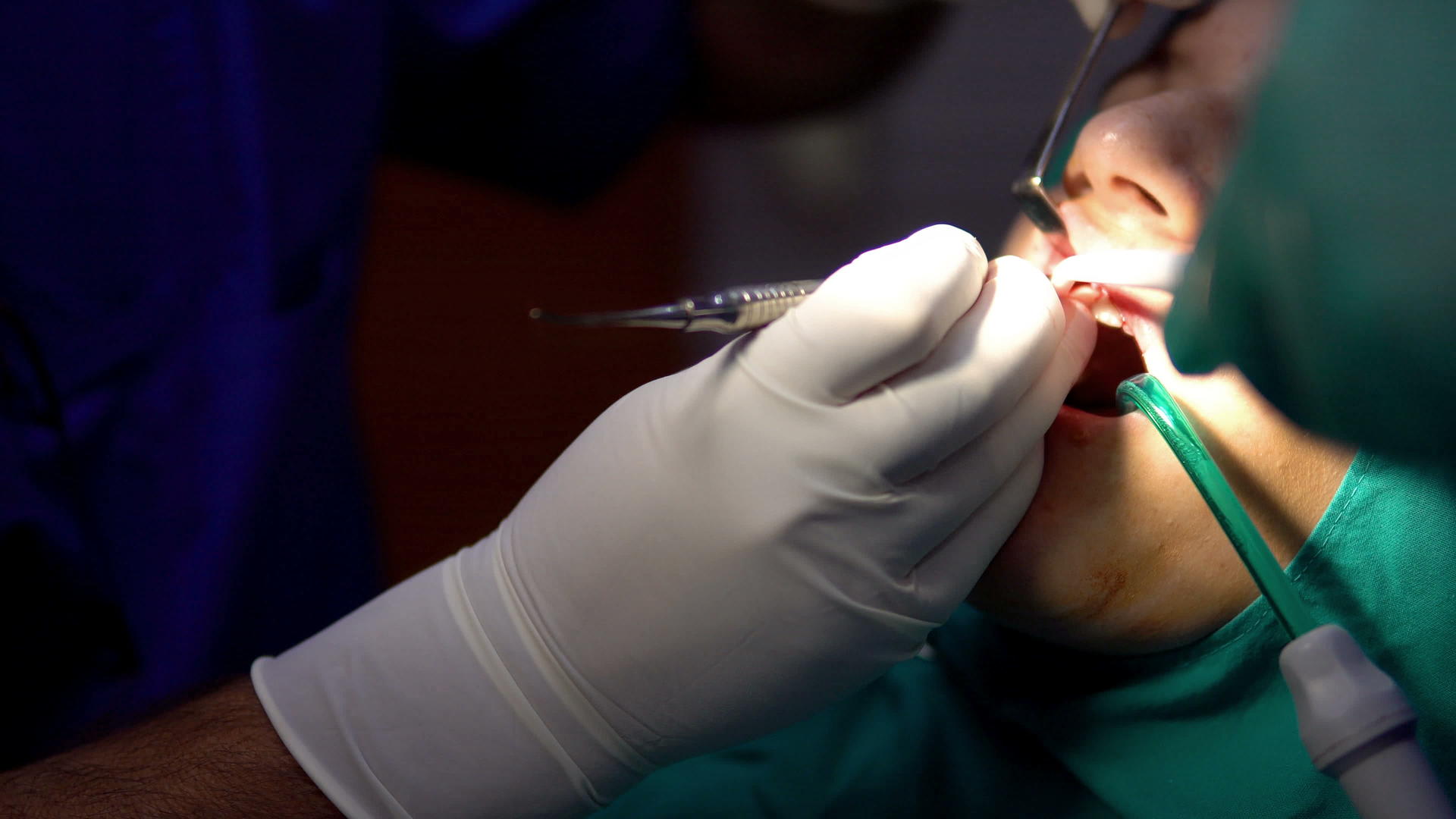 口腔手术室视频的预览图
