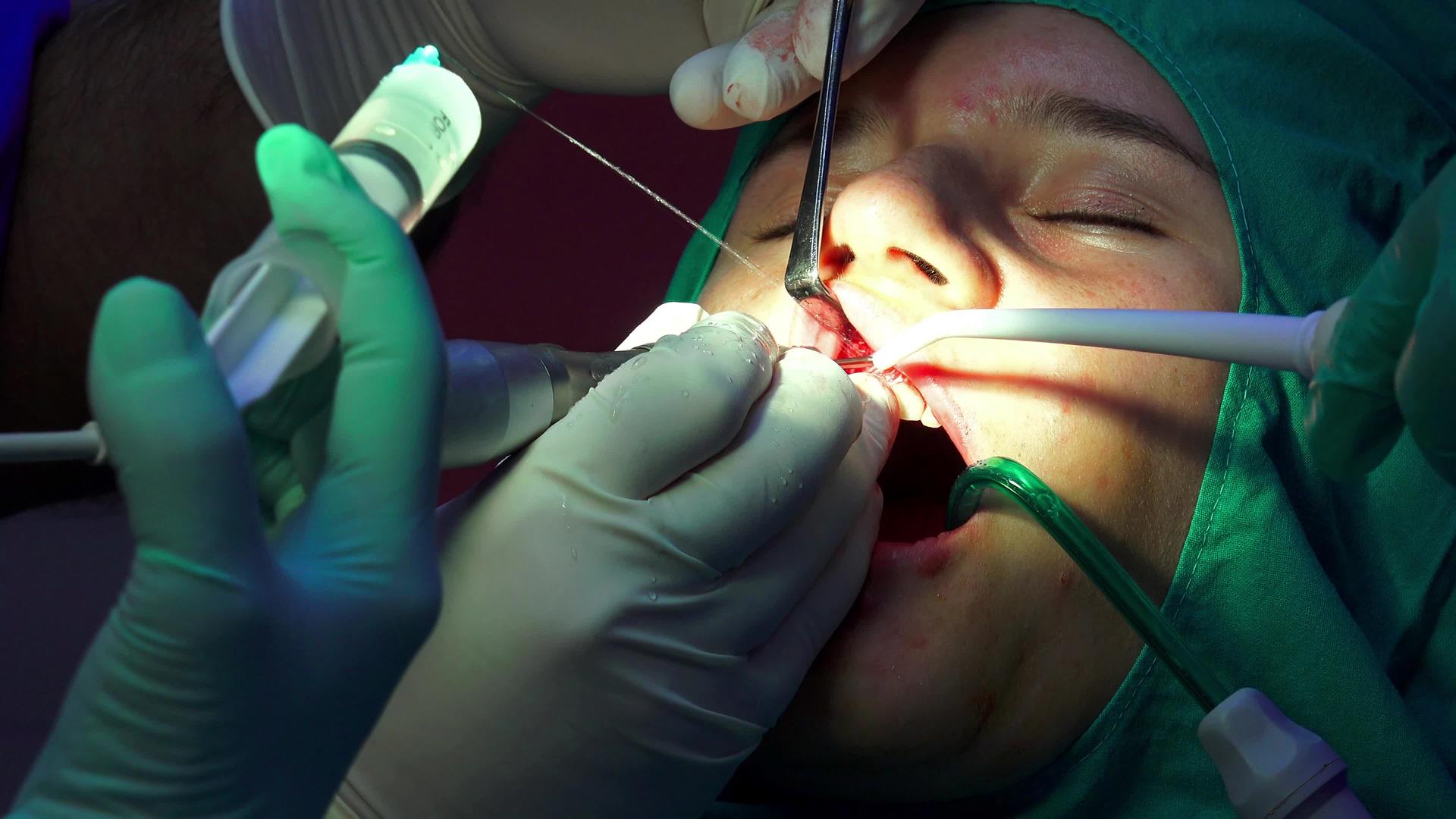 口腔外科口腔外科手术视频的预览图