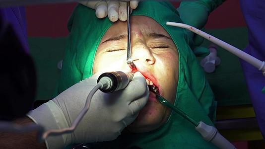 口腔外科口腔外科手术视频的预览图