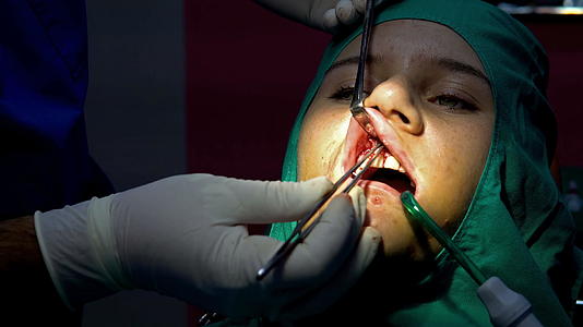 口腔手术手术脑切除手术室视频的预览图