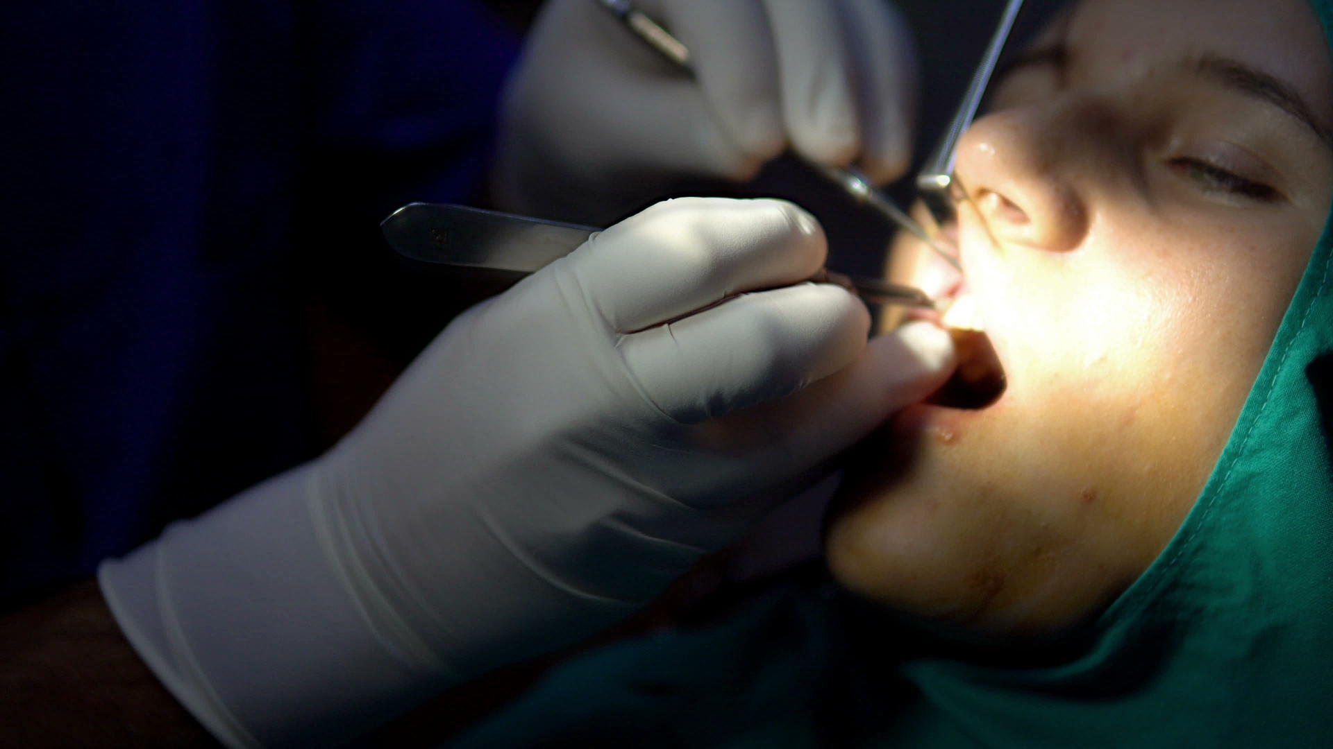 女性患者手术中的牙科外科医生视频的预览图