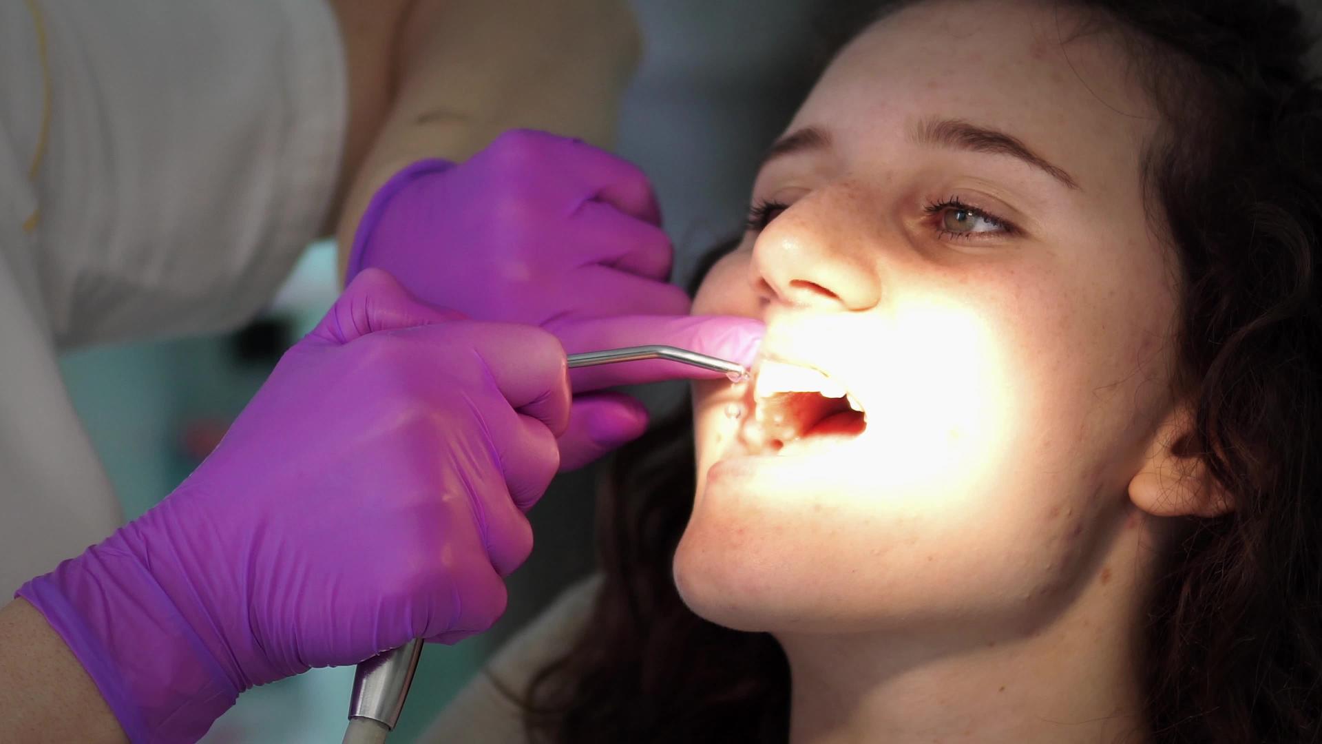 在牙科办公室为年轻女性患者进行专业牙科检查视频的预览图