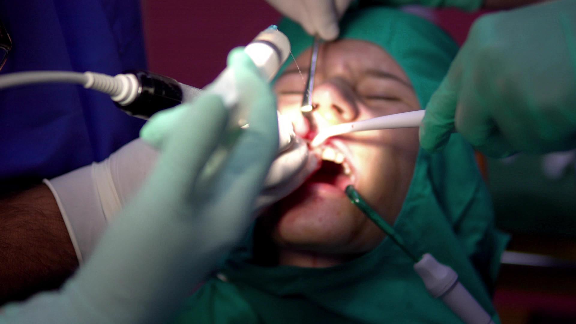 女青少年接受心细胞切除和牙科手术视频的预览图