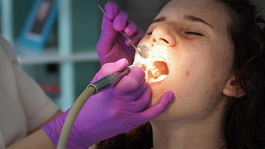 牙科涡轮钻治疗龋齿保护视频的预览图