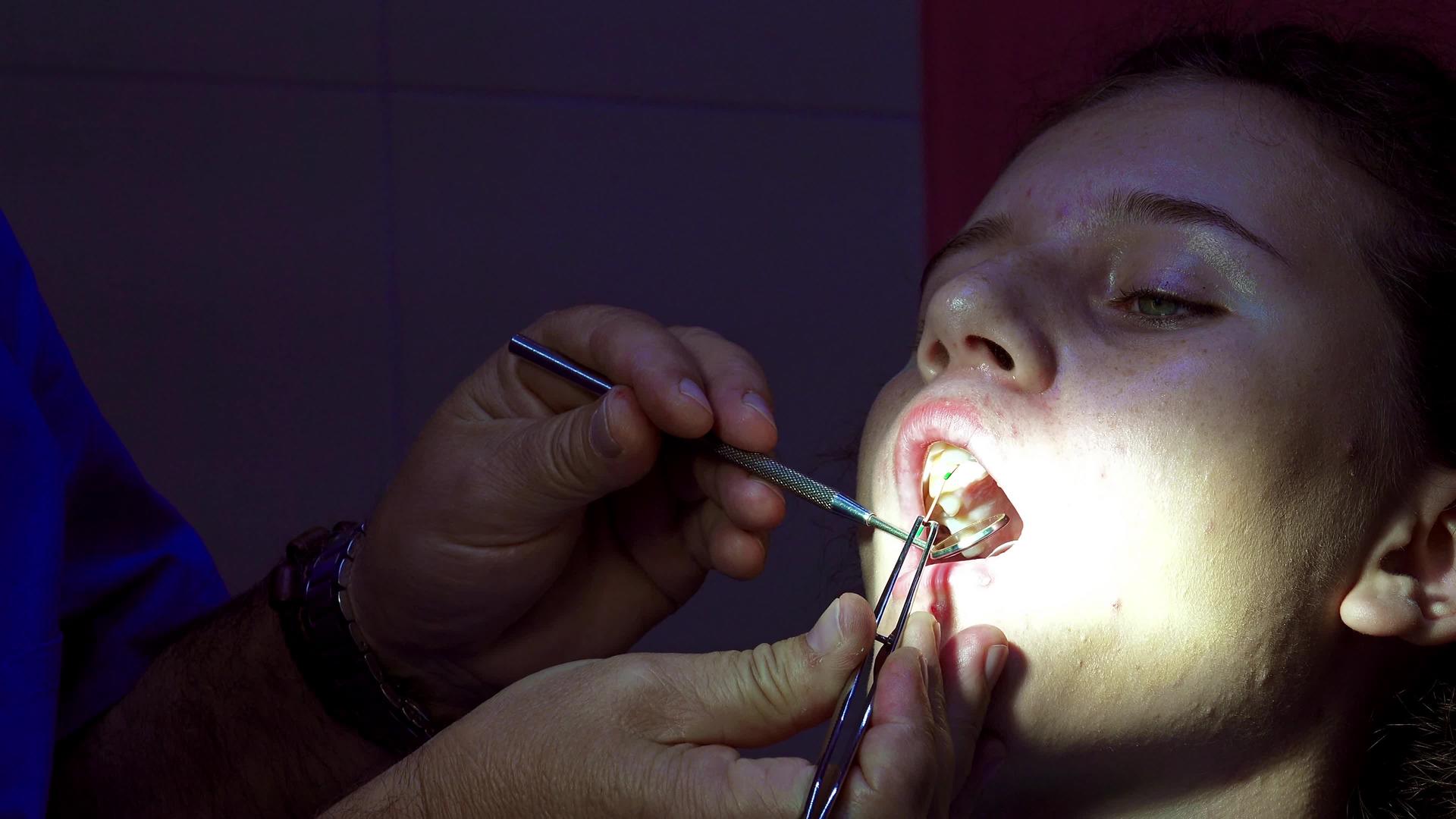 在申请内肠牙管填充申请期间牙科女性牙医在牙科视频的预览图