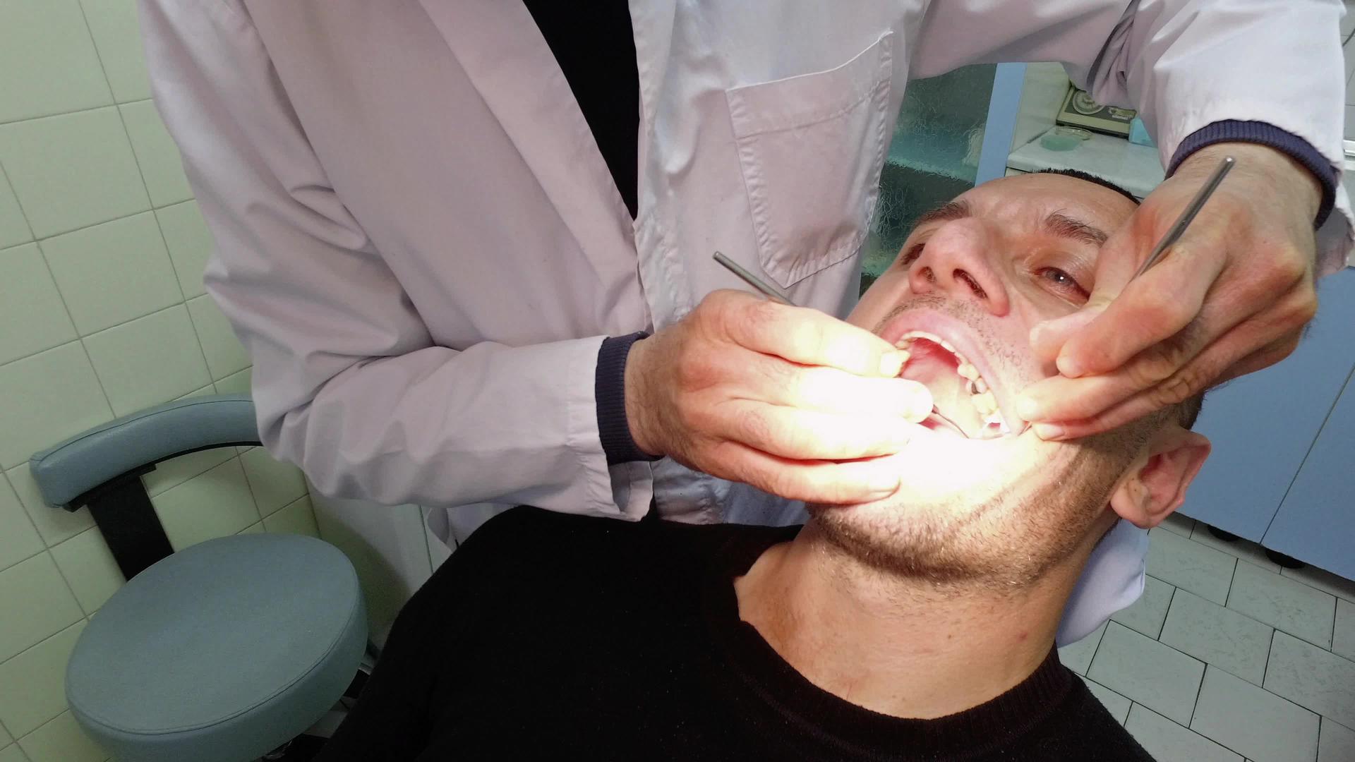牙科诊所健康男性客户牙科检查健康状况视频的预览图