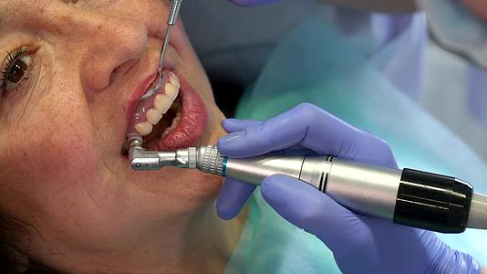 口腔牙医将预防杯移动到切割器上方视频的预览图