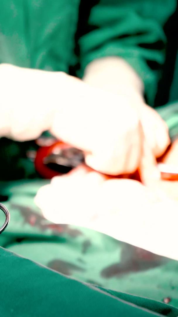 医院手术室手术器械实拍视频的预览图