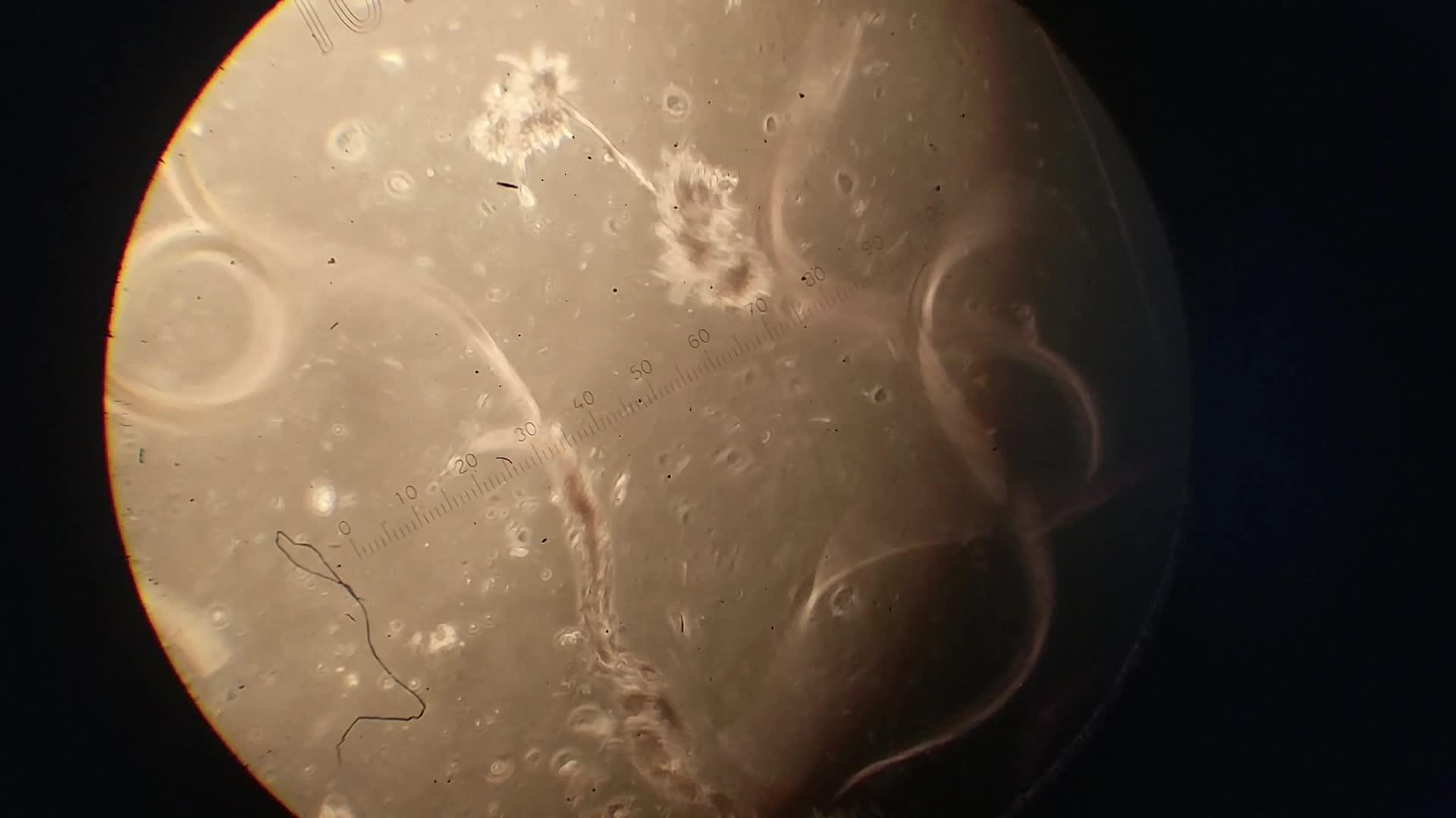 显微镜放大镜下微生物或微生物的特写而不是3d动画视频的预览图