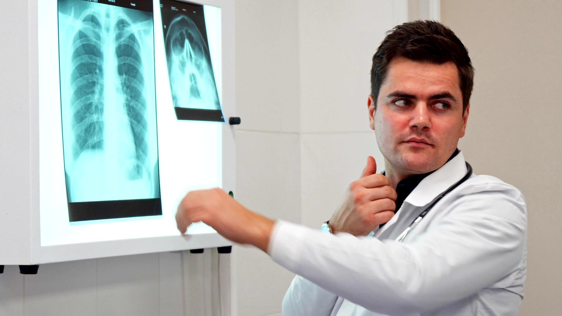 男医生用X光图像握住他的手视频的预览图