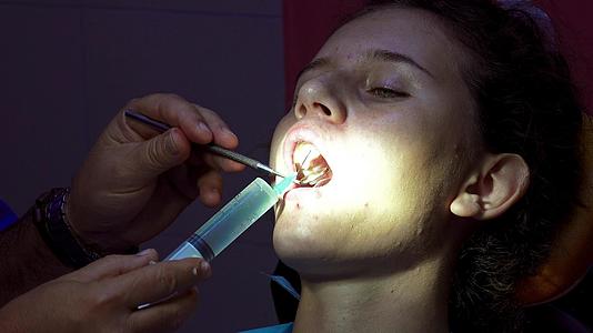 牙医在口腔手术前用注射器对牙齿进行消毒视频的预览图