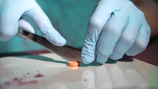 医生用手在医学实验室血滴周围的手术刀在桌子上用橙色的药丸视频的预览图