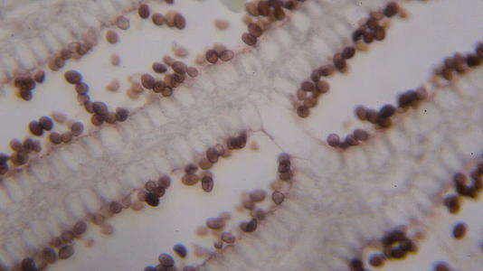 显微镜下的agaricus部分视频的预览图