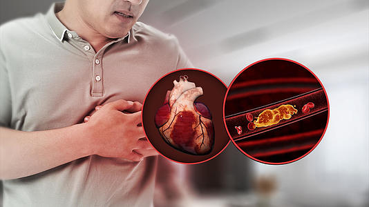 高血压心脏展示背景视频视频的预览图
