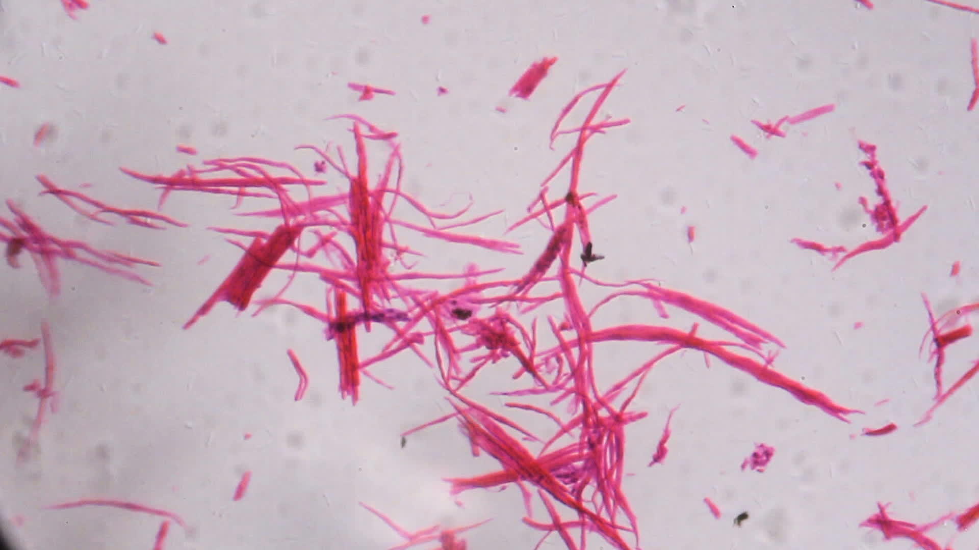 光滑的肌肉在显微镜下分离白色背景上有抽象的粉色线条视频的预览图