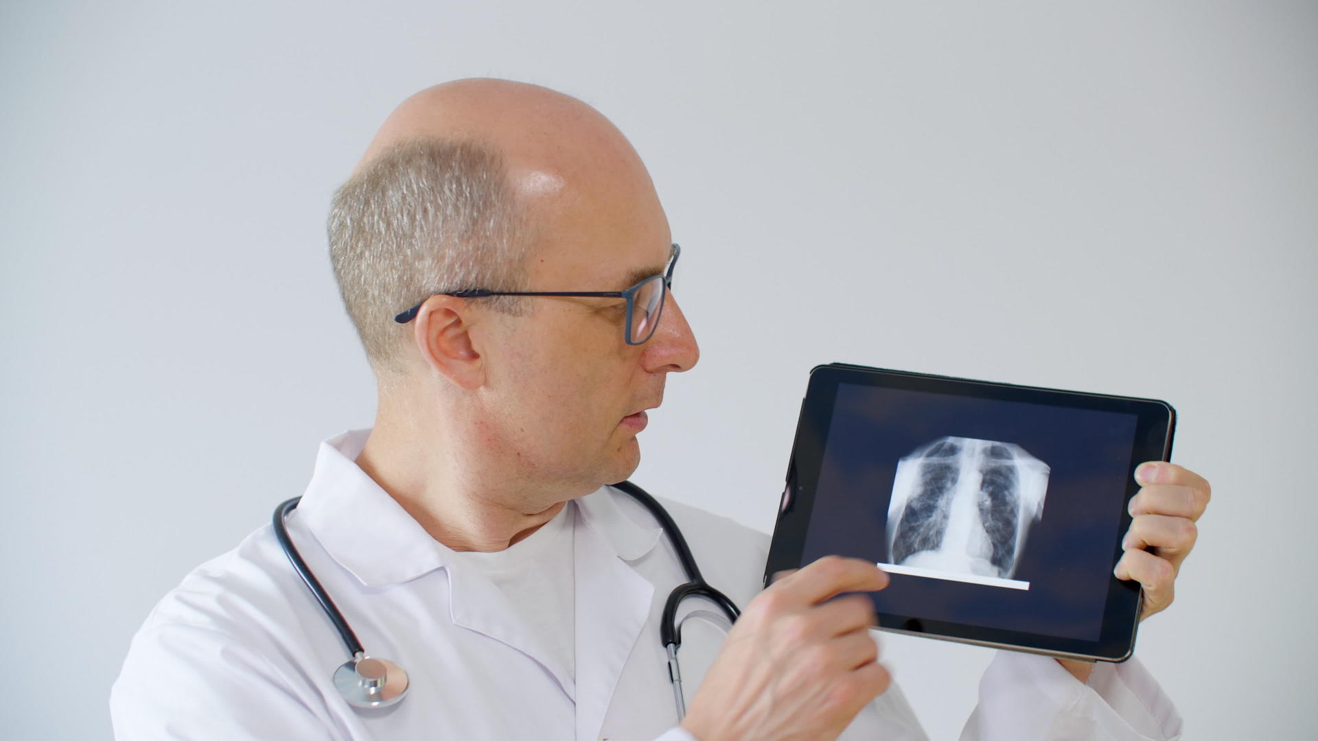 在线咨询中肺科医生显示肺部计算透视和切片治疗师视频的预览图