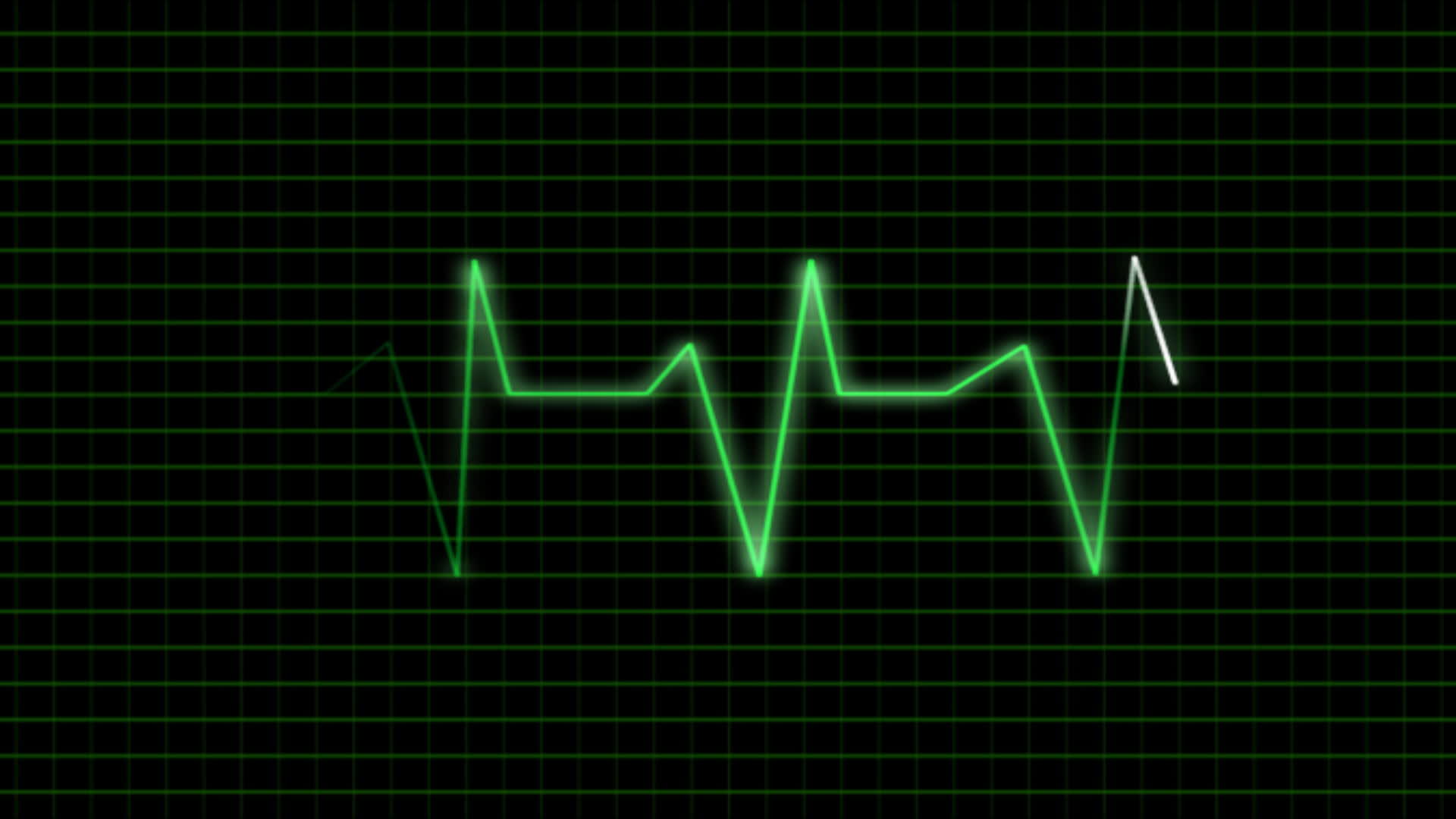 ecg心脏脉冲视频的预览图
